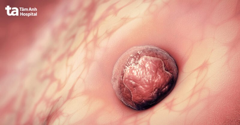 Nghi lễ cúng kính cầu mong phôi bám vào tử cung thành công và có con