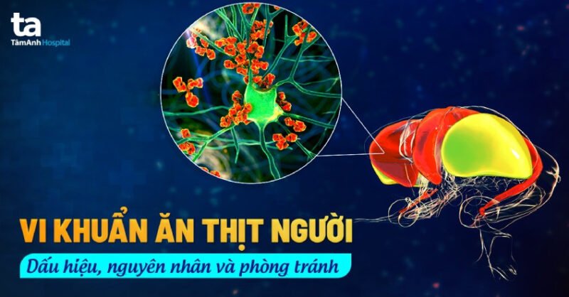 Hình ảnh minh họa vi khuẩn ăn thịt người gây viêm cân mạc hoại tử, cho thấy sự phá hủy mô