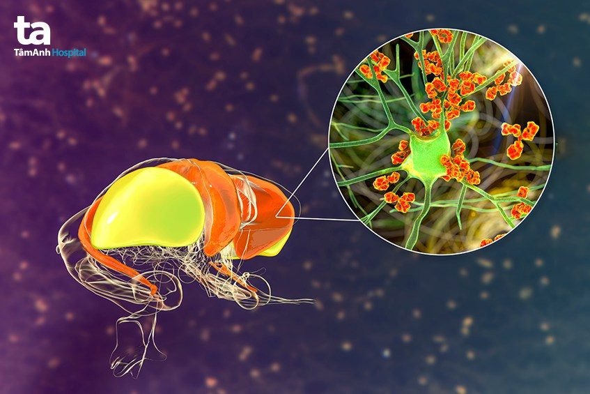 Môi trường sống của vi khuẩn gây viêm cân mạc hoại tử, minh họa các nguồn lây nhiễm tiềm ẩn