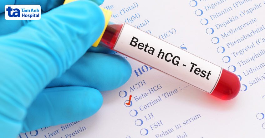 Xét nghiệm định lượng beta hCG là thước đo chính xác nhất để biết mang thai hay không sau chuyển phôi